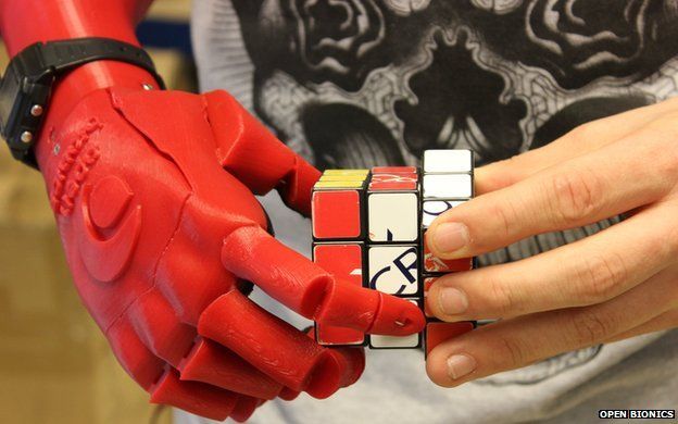 Open Bionics robotic hand for amputees